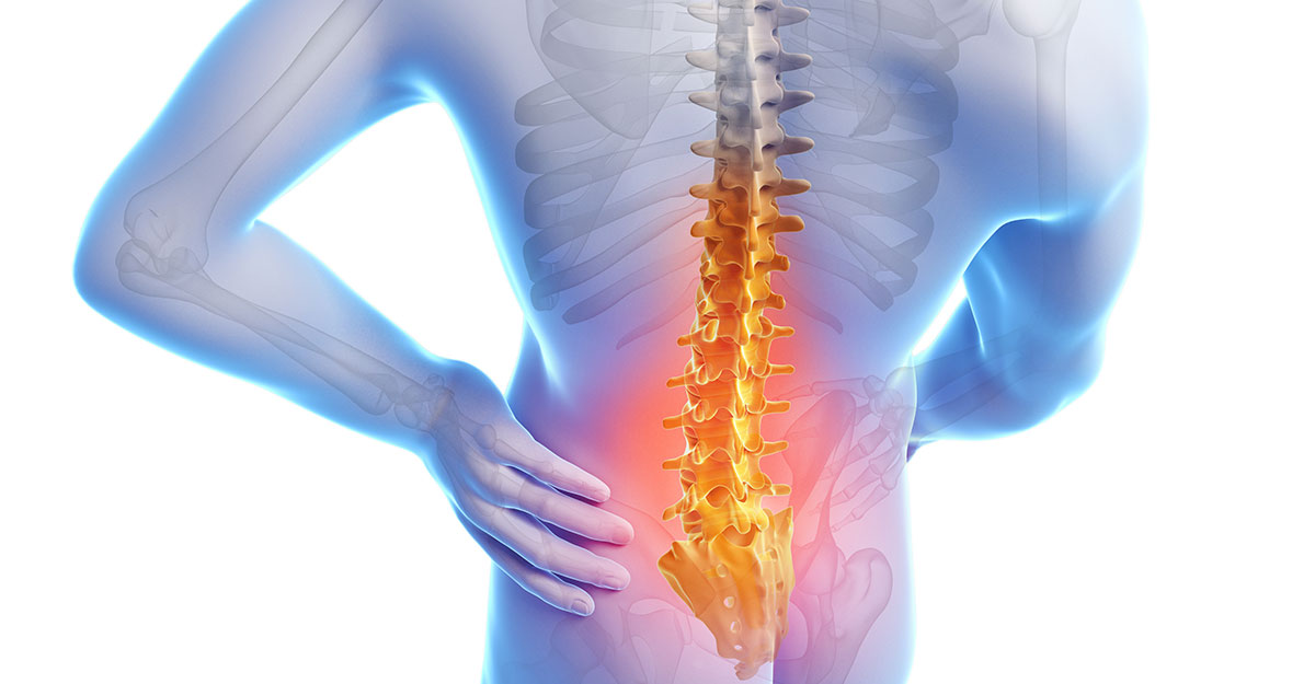 New York Back Pain Treatment without Surgery