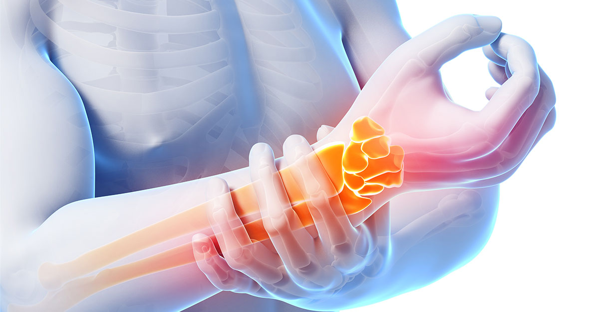 New York natural carpal tunnel treatment